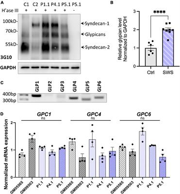 A Dominant Heterozygous Mutation in COG4 Causes Saul–Wilson Syndrome, a Primordial Dwarfism, and Disrupts Zebrafish Development via Wnt Signaling